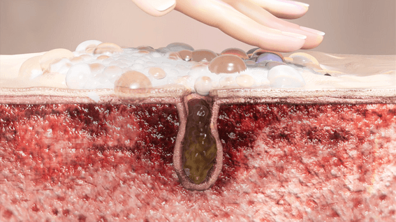 드롭샷매치 포트폴리오 - 뷰앤디 얼굴 세안 효능 홍보 영상