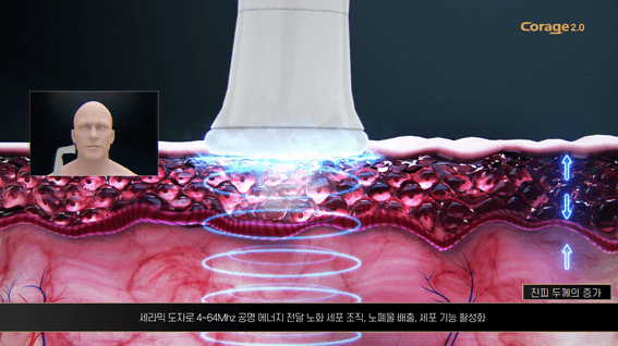 드롭샷매치 포트폴리오 - 퀀텍 의료기기 코레지2.0 홍보영상