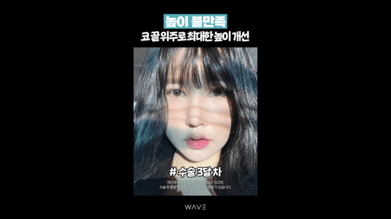 드롭샷매치 포트폴리오 - 성형외과 전후영상 쇼츠, 릴스