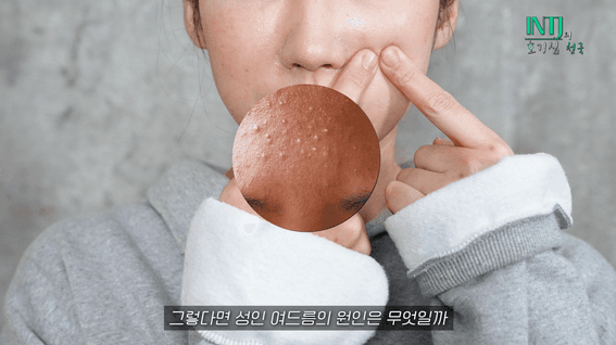 드롭샷매치 포트폴리오 - 여드름 화장품 홍보 유튜브 영상