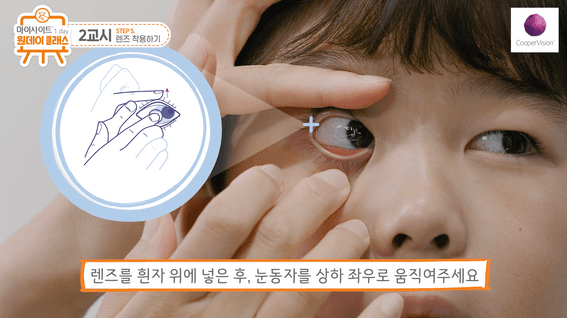 드롭샷매치 포트폴리오 - 쿠퍼비전코리아ㅣMiSight 1 day