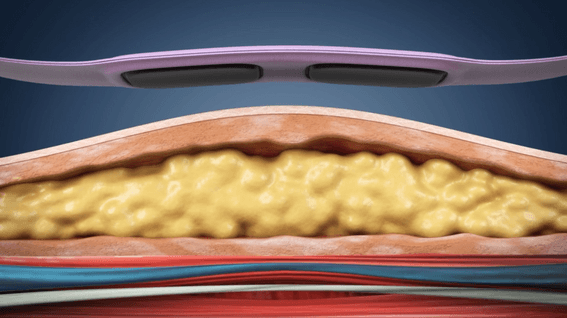 드롭샷매치 포트폴리오 - 발란스핏 상세페이지 3D 홍보 GIF 영상 제작