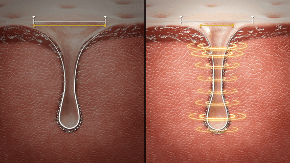 드롭샷매치 포트폴리오 - 모공 화장품 홍보 바이럴 GIF 광고 3D 영상 제작