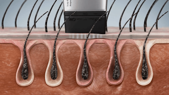 드롭샷매치 포트폴리오 - 모근 케어 제품 홍보 GIF 상세페이지 3D 영상 제작