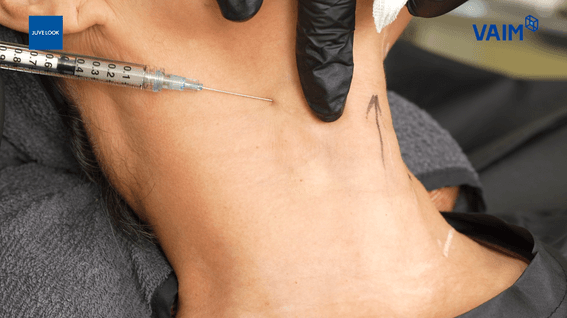 드롭샷매치 포트폴리오 - 바임글로벌 시술 영상 제작