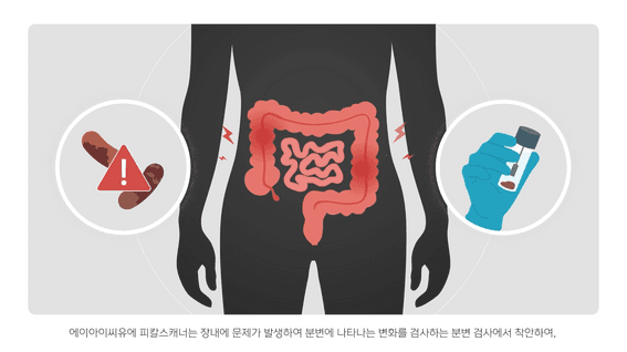 드롭샷매치 포트폴리오 - 피칼스캐너(대장외시경) 의료AI 소개영상