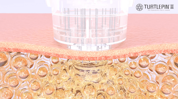 드롭샷매치 포트폴리오 - (주)제이엠바이오텍│제품 홍보영상