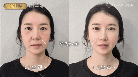 드롭샷매치 포트폴리오 - 나의미래의원 실제환자영상 후편집