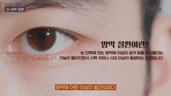 드롭샷매치 포트폴리오 - 스마일라식 이런 분들은 절대 받으시면 안 됩니다 | #스마일라식