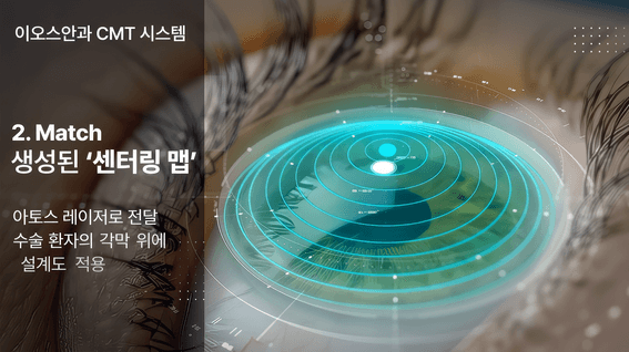 드롭샷매치 포트폴리오 - 이오스안과ㅣ스마트노바라식