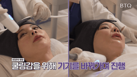 드롭샷매치 포트폴리오 - 통통한 얼굴형의 여성 모델 ✨리프팅 후 V라인 완성✨ ｜엑셀 웨이브&쿨소닉