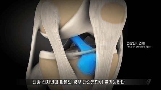 드롭샷매치 포트폴리오 - 디스크 발생 요인 (경추)