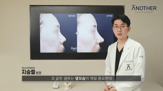 드롭샷매치 포트폴리오 - 어나더성형외과 유튜브 구축코편