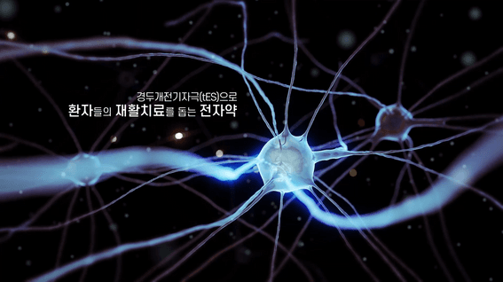 드롭샷매치 포트폴리오 - 뉴로핏innk 경두개 전기 자극기기 3D그래픽 소개 영상